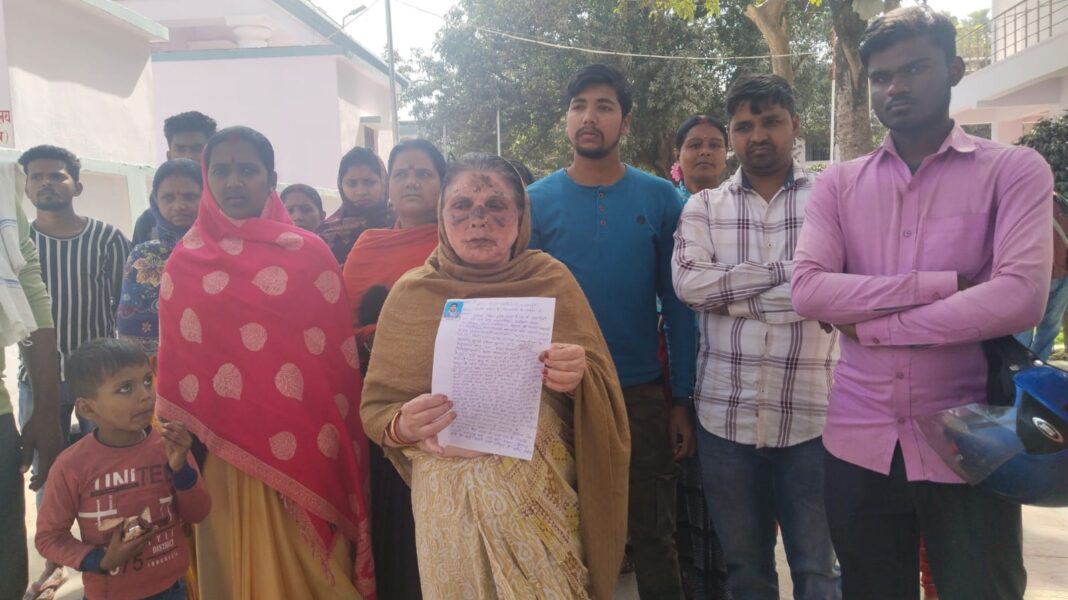 BHAGALPUR NAVADQA ACID ATTACK ACCUSED RANJEET'S MOTHER