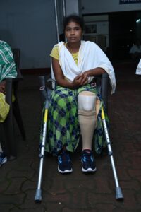 Artificial Leg
