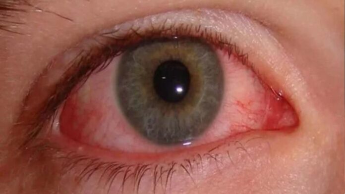 eye.jpg
