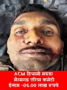 एसीएम हिचामी मडडा