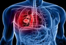 फेफड़ों की गंभीर बीमारी COPD के लिए नई उम्मीद, गेमचेंजर इंजेक्शन से इलाज होगा आसान