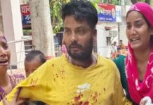 मेरठ में रोटी-फास्टफूड के झगड़े से हुआ खूनी बवाल, ससुराल और मायके पक्ष में हुई जोरदार मारमारी Meerut Roti-Fast food Clash